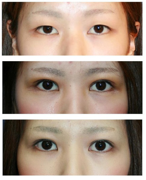 æåäººã®å¹¼å°æç»åï¼ã³ã¡ã³ã277