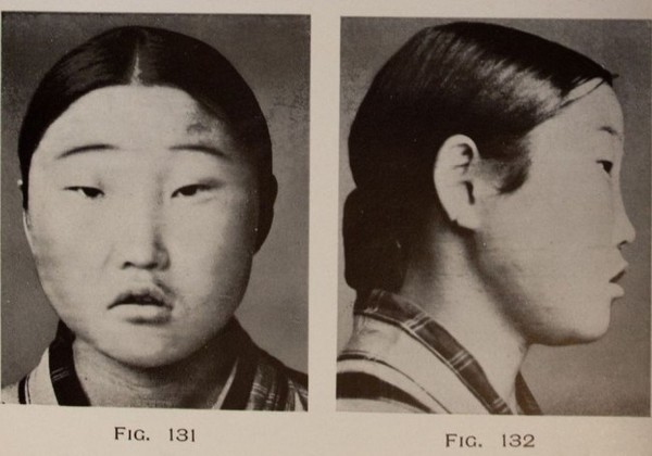 有名人の幼少期画像：コメント537