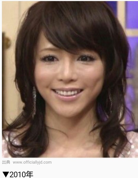 整形 芸能人：コメント191