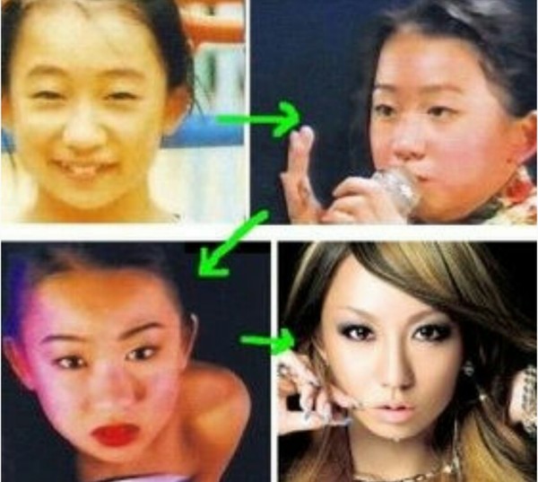 整形 芸能人ï¼ã³ã¡ã³ã41