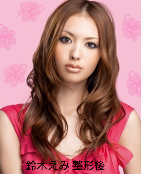 整形 芸能人ï¼ã³ã¡ã³ã510