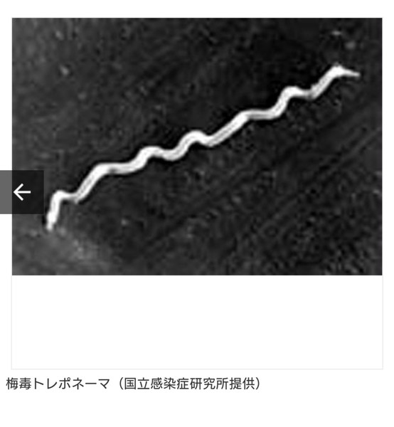 風俗で働いている、働いていた人に偏見はありますか？：コメント4134