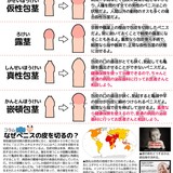 仮性包茎が正常であることが証明される。ズルムケはむしろ異常だと判明