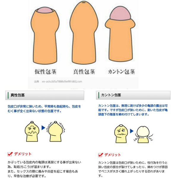 åèæè¡ã¯å½ãããçã¿ãè«ããåºè¡ãå£æ­»ã®çä¾ããæ¶è²»èã»ã³ã¿ã¼ãç·æ¥æ§ããªããªãããã¨ããï¼ã³ã¡ã³ã28
