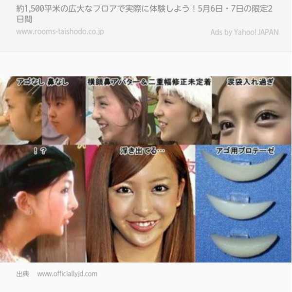 高須克弥院長「アヒル口、涙袋、みんなキライ。僕の美的感覚とズレている」：コメント27