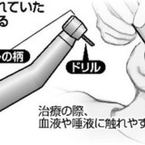 歯削る医療機器、半数使い回し…院内感染の恐れ