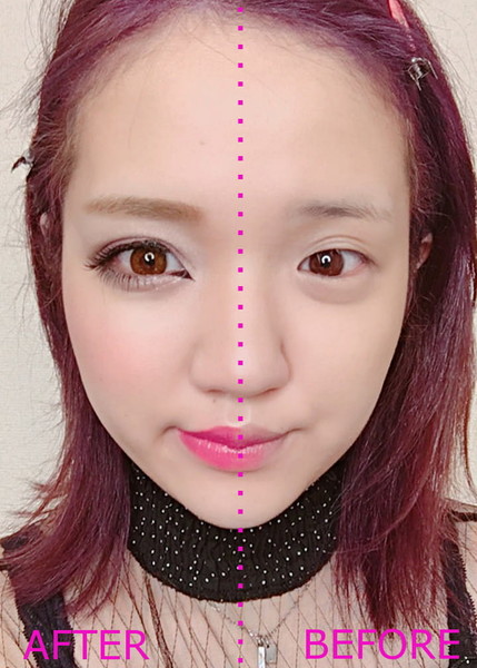 美容系ユーチューバー『日本ばいばい』動画で炎上 不確かな治療法を批判され「虐めと一緒だよ」と反論：コメント3