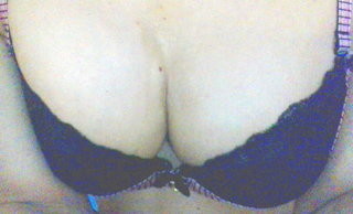 脂肪注入豊胸の経過を報告するトピ：コメント23