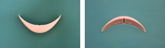 顎プロテーゼ入れてる人集まれ：コメント11