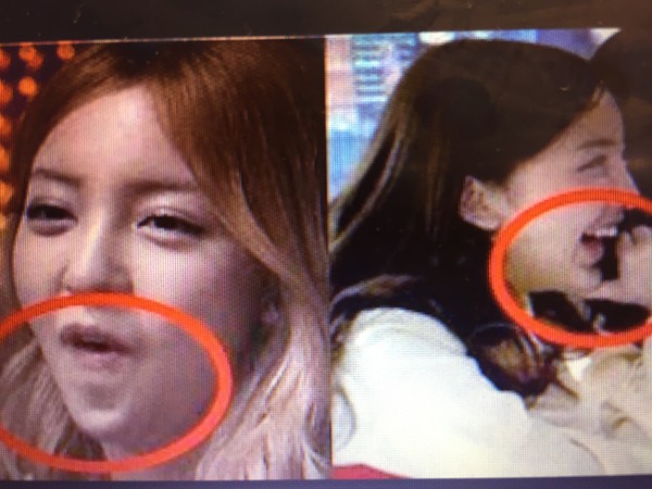 顎プロテーゼ入れてる人集まれ：コメント14