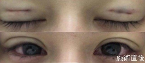 ç¾å®¹æ´å½¢å¤±æãèªãããï¼ã³ã¡ã³ã92