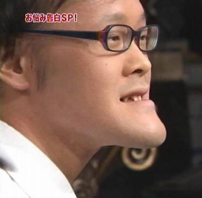 しゃくれあご整形で治した人・治したい人：コメント1