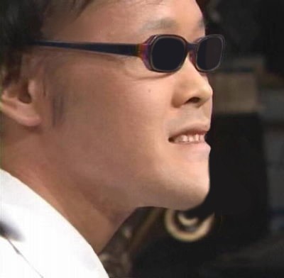 しゃくれあご整形で治した人・治したい人：コメント15