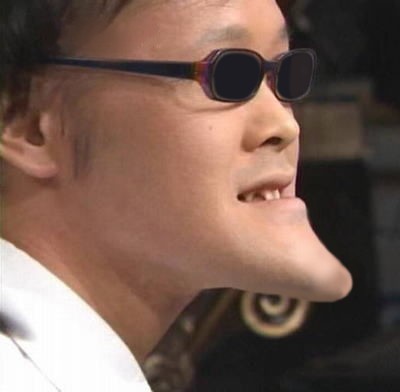 しゃくれあご整形で治した人・治したい人：コメント14