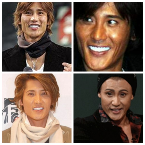 新庄剛志、目玉を整形予定　「そのままでよかった」「気味悪い」と嘆く声も：コメント18