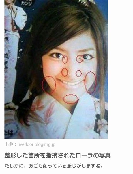 “CM女王”ローラ、古巣のモデル業界から総スカン!?「もう旬はすぎた」評価で、個人営業も成果ナシ:コメント16