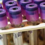 子どもの自閉症は88%の精度で血液検査から予測できることが明らかに