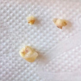 マック　マフィンに異物 金沢有松店　歯か、白い破片混入