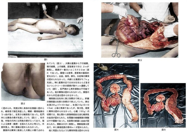 「死に至る可能性も」と警鐘 便秘大国日本の実態:コメント11