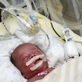  「母乳バンク」全国整備へ 低体重児の病気リスク減