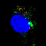 認知症の原因物質　歯周病によって蓄積する仕組みを解明