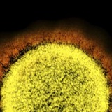 コロナ死亡率に大きな地域差　岩手など3県は5％超、東京1％