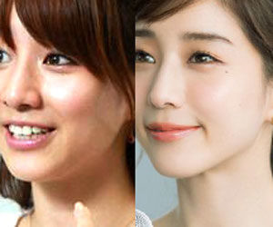 田中みな実、知人が不妊治療で「心身ともにまいってしまって…」保険適用拡大に期待:コメント5