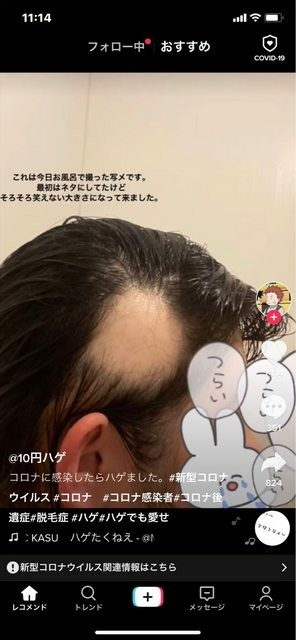 湘南に多い都内ナンバー、渋滞相次ぐ…「地元の人はステイホームしてるのに」:コメント13