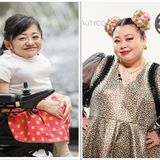 渡辺直美さん動画で何度も泣いた。障害者として考える「見た目いじり」の終焉