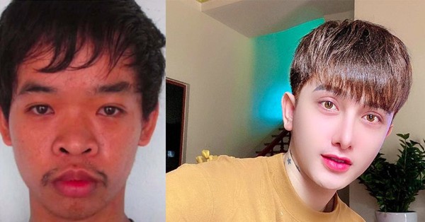 「君の容貌では就職できない」と言われた26歳男性、整形でまるで別人に 親でさえ認識不可(ベトナム):コメント15