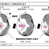 40代の出産相次ぐ芸能界、注目される高齢出産　「35歳以上は危険」は本当？　専門医が明かすリアル