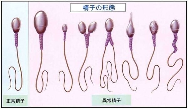 学力「遺伝の影響が50%」、中学生以降は遺伝的エンジンで走り出す…努力や教育による底上げはムリ?:コメント2