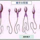 学力｢遺伝の影響が50%｣､中学生以降は遺伝的エンジンで走り出す…努力や教育による底上げはムリ？